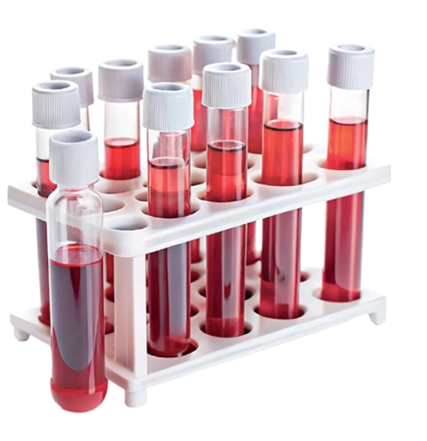 Kansızlık Hakkında Bilmeniz Gerekenler