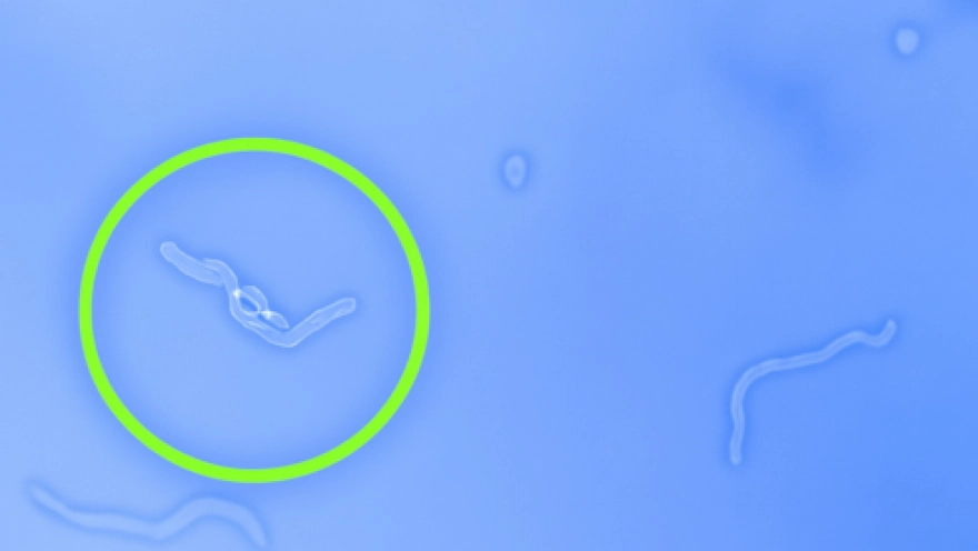 Gözlerdeki uçuşan cisimleri gördüğünüzde 3 hareketle onlardan kurtulun