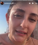 Ünlü Şarkıcı Melek Mosso Kafa Üstü Düştü: “Lütfen Dua Edin”